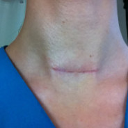 The Scar that Became An Accessory for Her Personal Brand Message!
