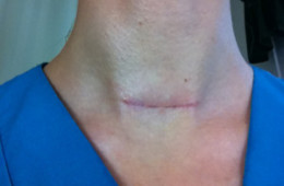 The Scar that Became An Accessory for Her Personal Brand Message!